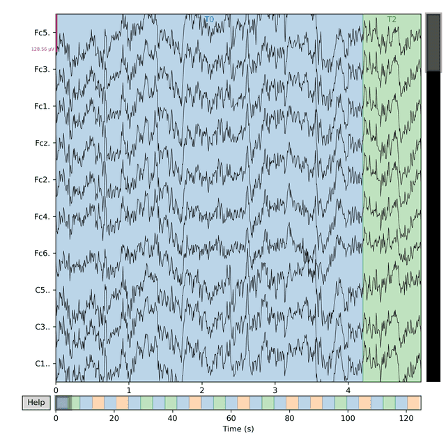 Raw multi-channel EEG signal waveform