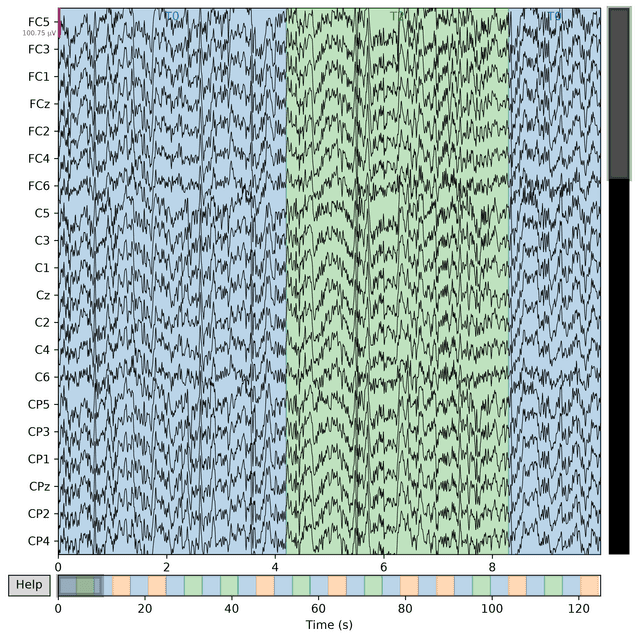 Cleaned EEG signal after ICA-based artifact removal