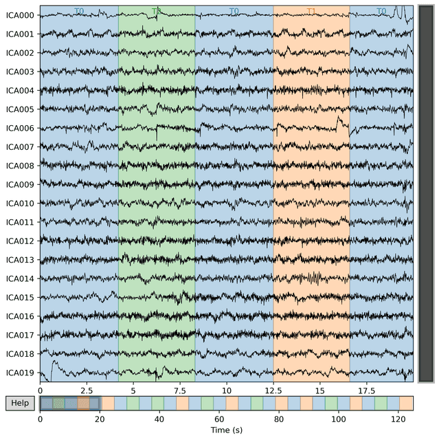 ICA-separated EEG source components