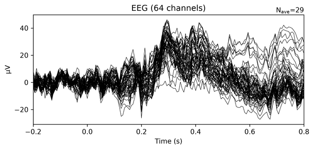Baseline-corrected EEG epochs